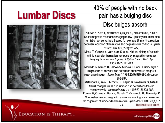 X ray image displaying lumbar discs and relating to backache and back pain