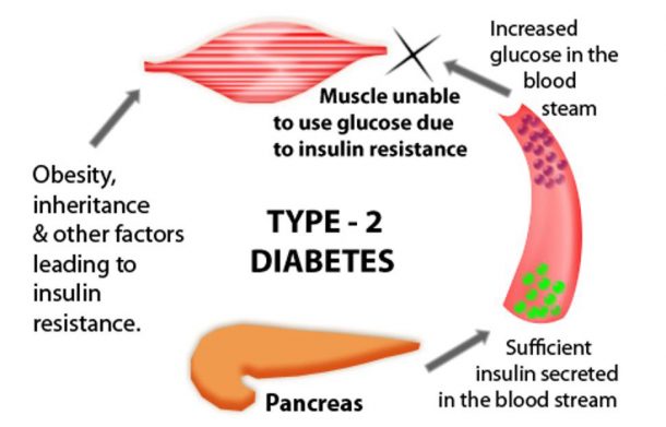 7. How Tattoos Can Affect Blood Sugar Levels in People with Type 2 Diabetes - wide 4