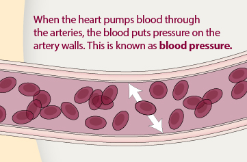 An infographic of an artery that shows what blood pressure is. 