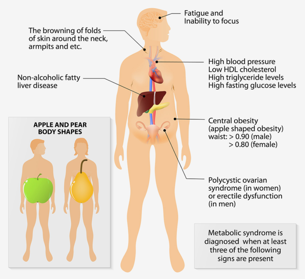 A cartoon drawing of an obese person with all of the criteria for metabolic syndrome labeled on their body. 