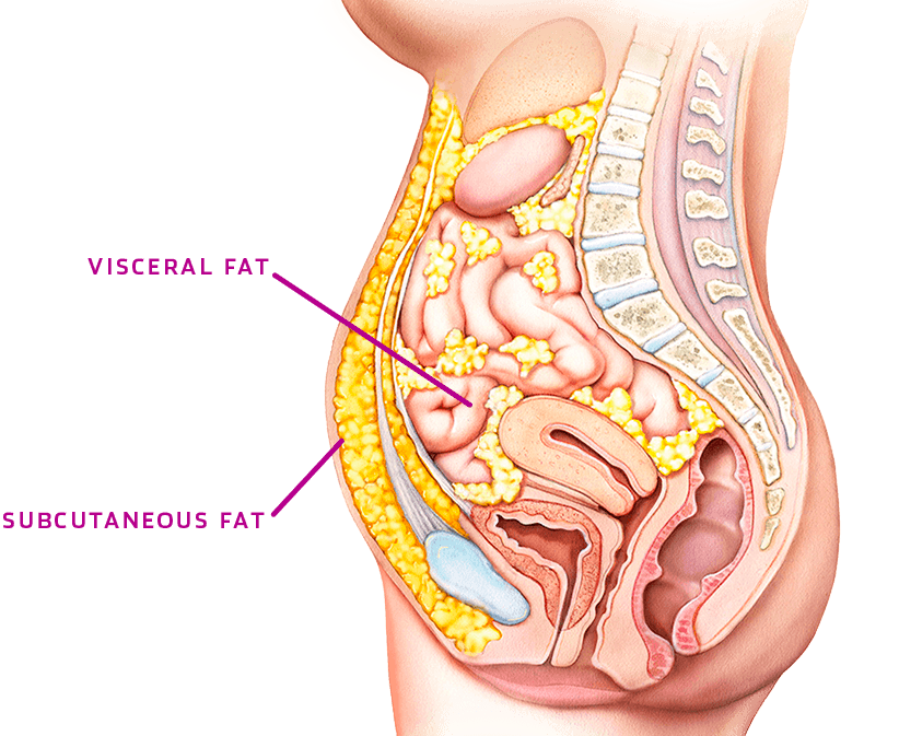 A diagram of visceral and subcutaneous fat. 