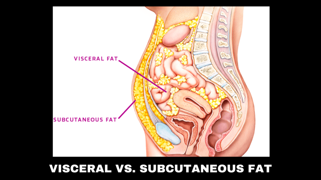 A picture of visceral vs subcutaneous fat on the human body. 